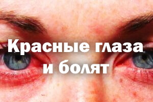 Красные глаза и болят - причины Покрасневшие глаза и болят - причины