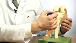 Поменять Заболевания колен