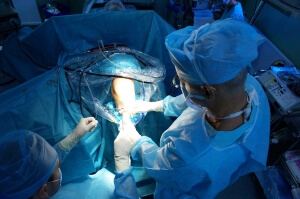 Хирургия Операция