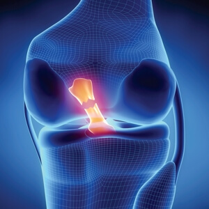 Рентген Снимок