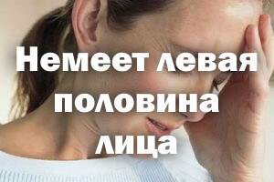 Немеет левая часть лица Немеет левая половина лица
