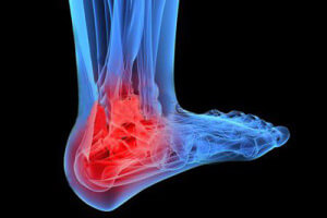 Травма Рентген