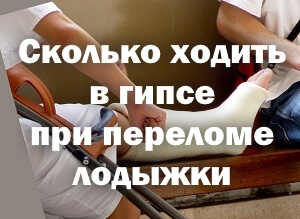 Как долго ходить в гипсе Сколько ходить в гипсе при переломе лодыжки