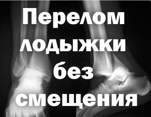 Снимок Рентген