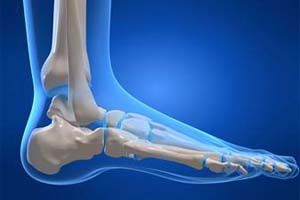 Поменять Перелом лодыжки