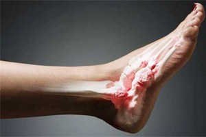 Поменять Травмы лодыжки