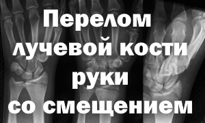 Как лечить Рентген