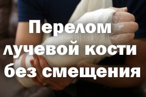 Лечение перелома лучевой кости без смещения Перелом лучевой кости без смещения