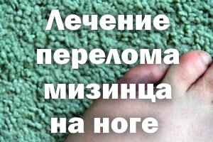 Как лечить сломанный мизинец Лечение перелома мизинца на ноге