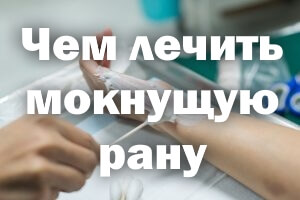 Мокнущая рана Мокнущая рана - чем лечить