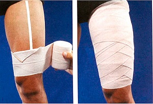 Перевязываем Перевязка