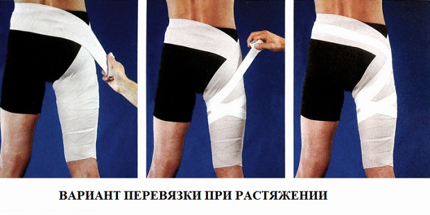 Перевязка Как делается перевязка