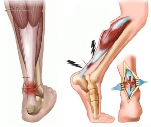 Рисунок В разрезе