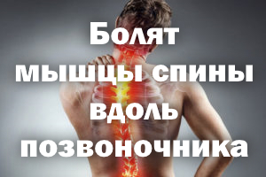 Болят мышцы спины вдоль позвоночника Болят мышцы спины вдоль позвонков