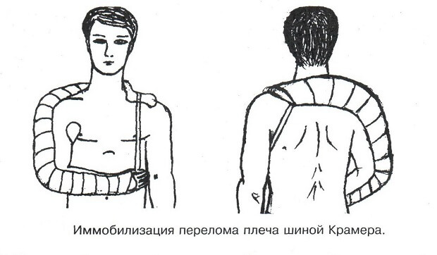 Крамера Шина Крамера