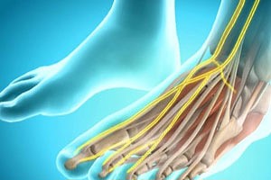 Недомогание в ноге Дискомфорт в ноге