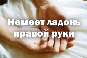 Немеет ладошка правой руки - причины Немеет ладонь правой руки - причины