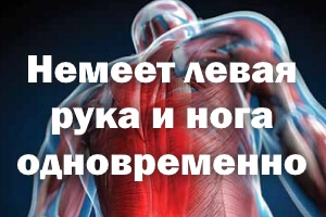 Немеет левая ручка и нога одновременно Немеет левая рука и нога одновременно