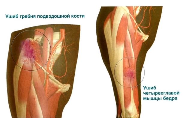 Сильное повреждение Повреждение
