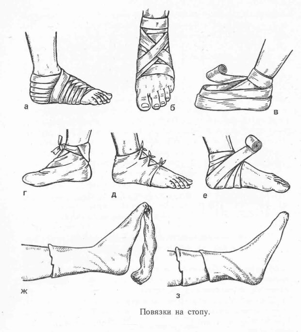 Перевязка Повязки