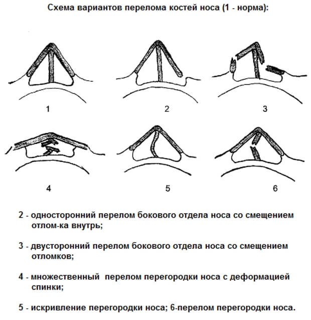 Виды Варианты