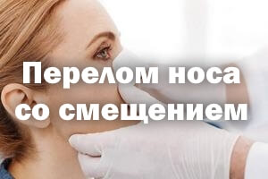 Смещенный Cо смещением