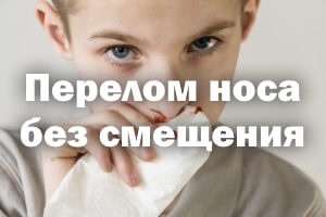 Сломан носа без смещения Перелом носа без смещения