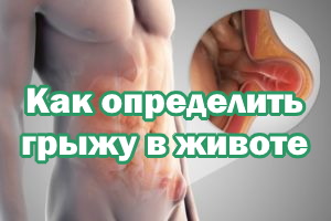 Как определить грыжу в животе Как определить грыжу в животике