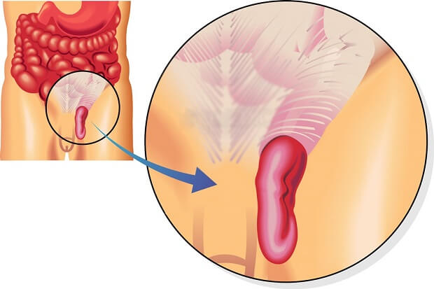 Схема Как выглядит