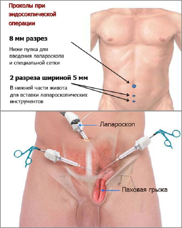 Операция Эффективная операция