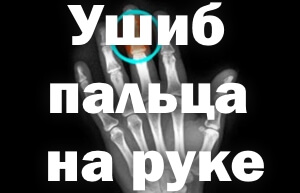 Повреждение Травмирование