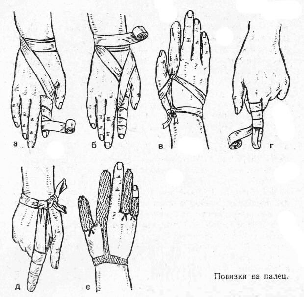 Марля Марлевая повязка