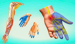 Парестезия безымянного пальца Парестезия безымянного пальчика