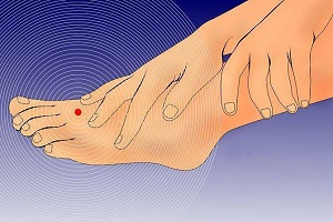 Парестезия левой ноги и руки Онемение левой ноги и руки