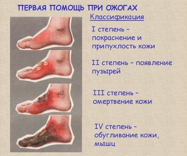 Различные степени Степени