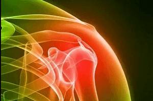 Перелом плечевого сустава Перелом плечевой кости