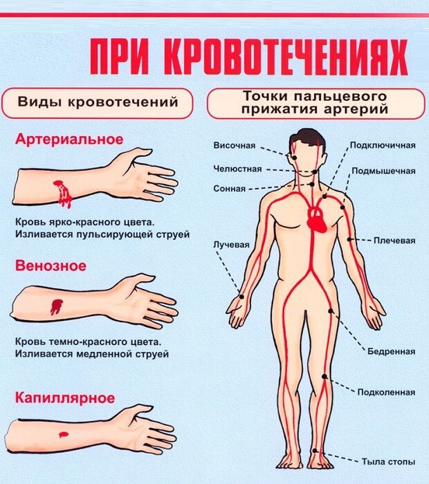 Поменять Помощь при кровотечениях
