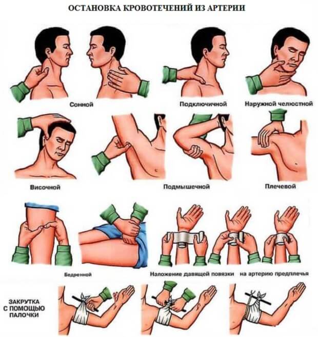 Поменять Первая помощь