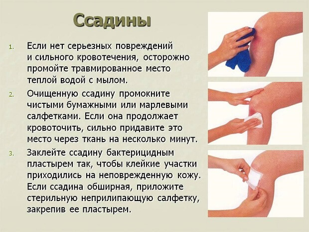 Помогаем При ушибе