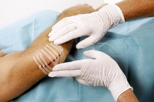 Рана При порезе