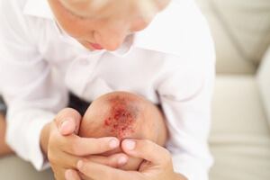 Восстановление Восстановление и заживление