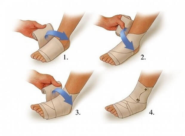 Перевязываем Перевязка