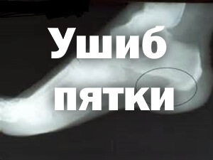 Снимок Рентген