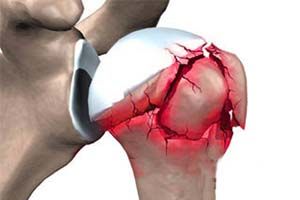 К чему приводит Сложности