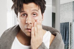 Алкоголь Похмелье