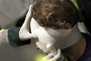 Помощь при ушибе