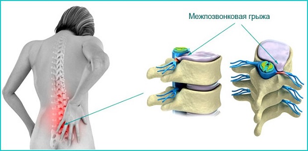 Эта проблема Появилась