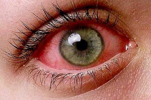 Появилась припухлость Образовалась припухлость