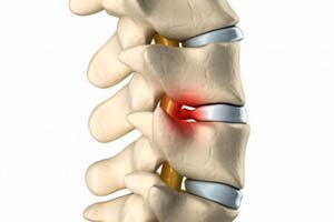 Какой бывает Виды