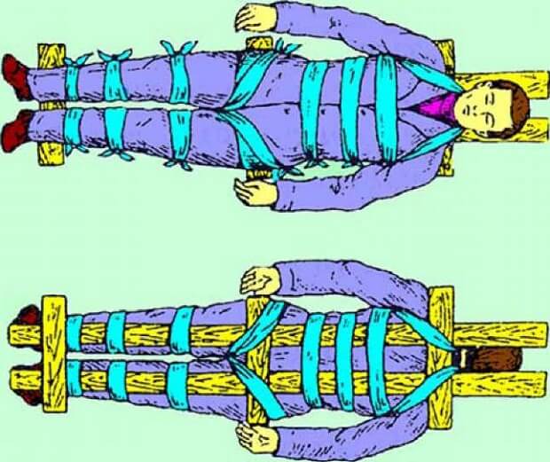 Передвижение Передвижение больного